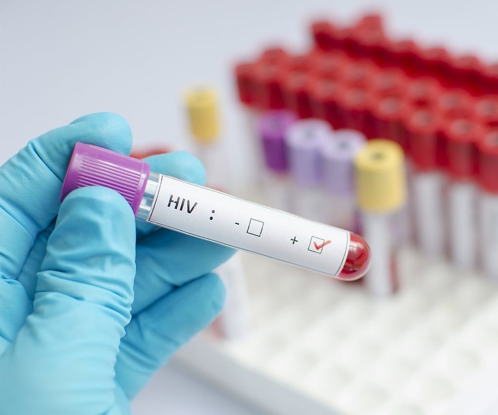 Tribunal de Contas determina suspensão de exame obrigatório de HIV em concurso de Foz do Iguaçu