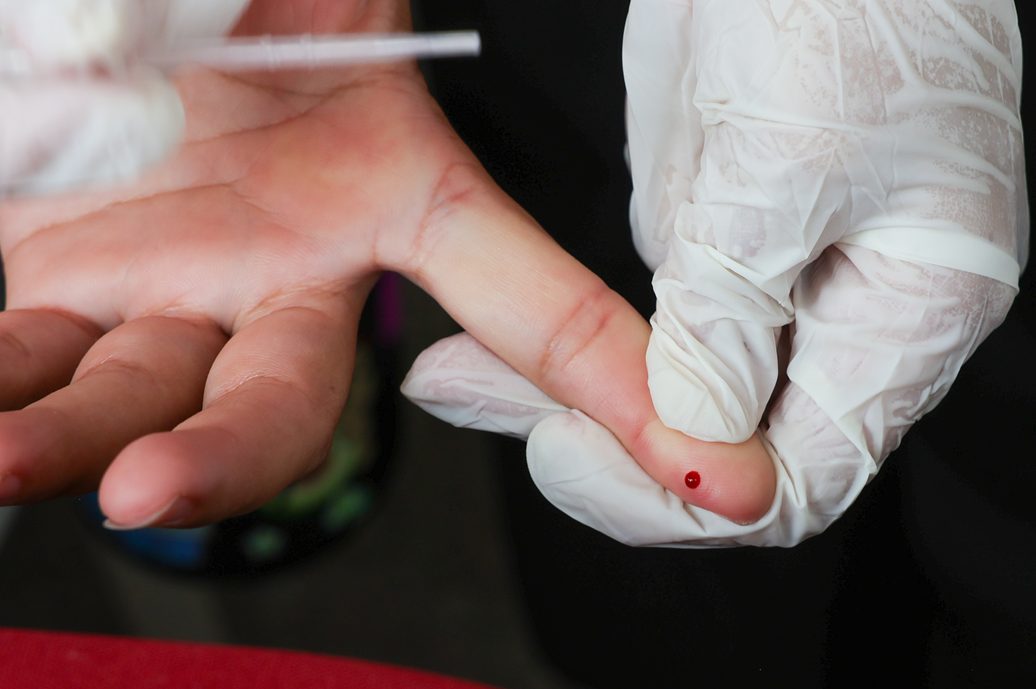 STM determina perda de patente de militar acusado de transmitir HIV